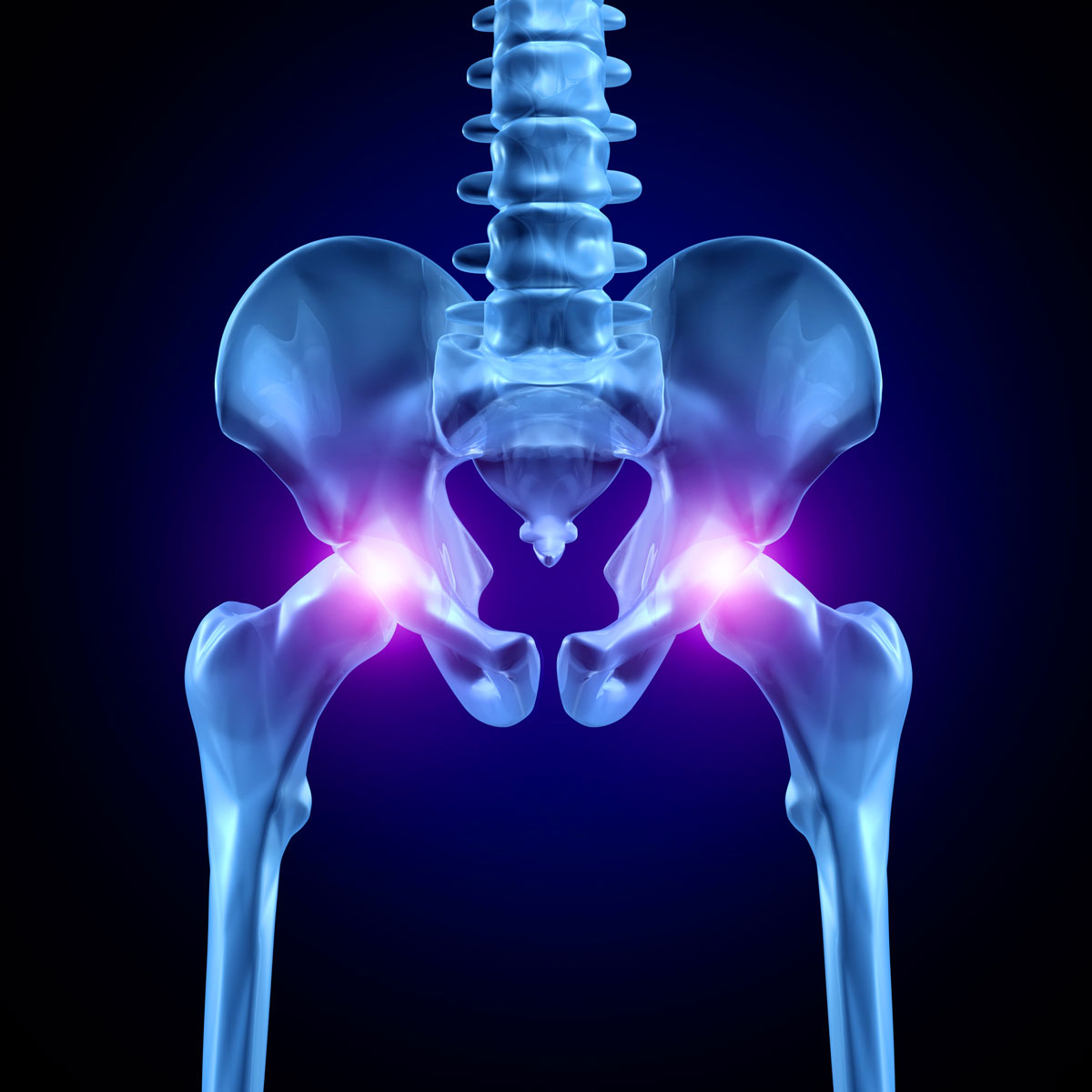Рентген тазобедренных суставов – цены, норма, расшифровка, подготовка, противопоказания