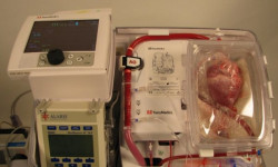 Новое устройство оживляет мертвое сердце для трансплантации
