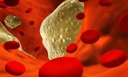 Новое антитело может снизить уровень «плохого» холестерина