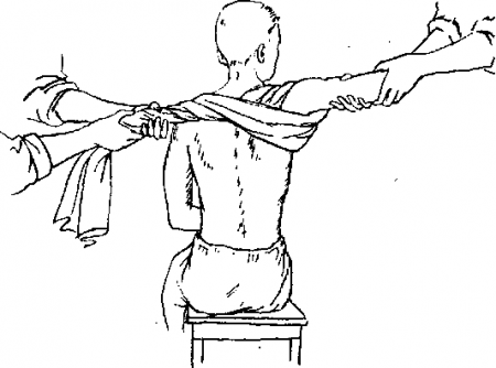 Вправление плечевого сустава