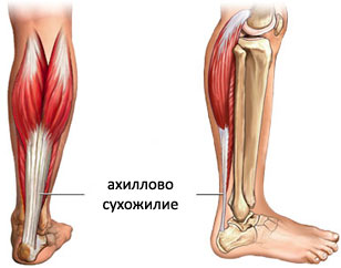 Изображение - Анатомия голеностопного сустава и стопы achilles-tendon31